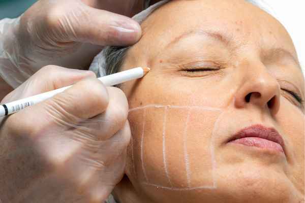 CryoPen: 5 Skin Concerns It May Be Used to Treat 4 What should you ask before having CryoPen treatment Dunchurch?