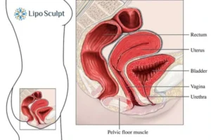 Treatment For A Leaky Bladder 2 How EM Chair treatment Dunchurch can help Leaky bladder issues. Read more now!