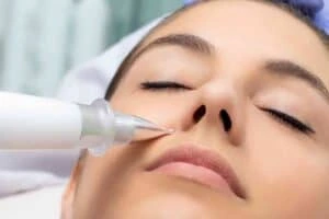 Best Actinic Keratoses Removal 3 Actinic keratoses Dunchurch solutions - book in today!