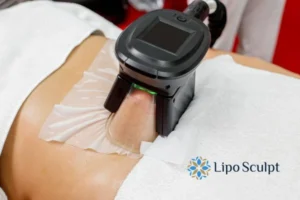 Does Fat Freezing At Home Work? 3 Fat freezing at home from Lipo Sculpt Dunchurch